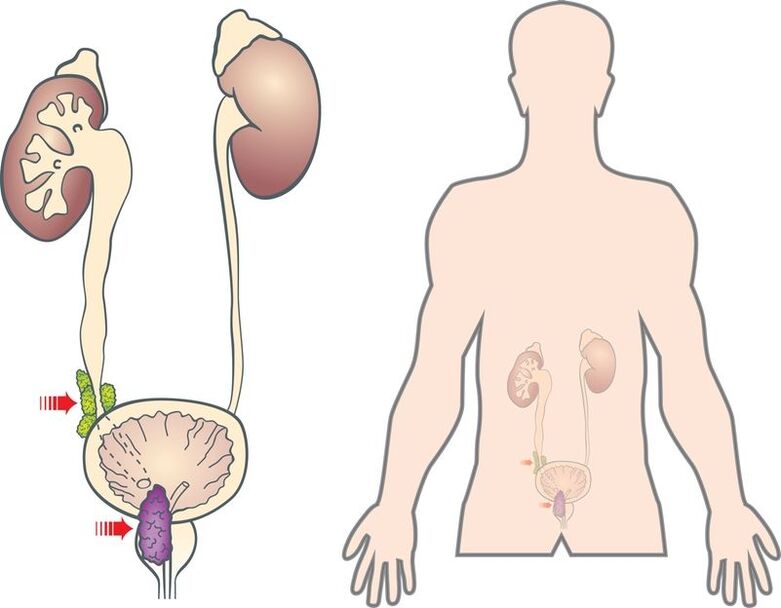 Symptoms and causes of prostate tumor