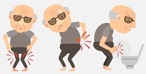 Prostatitis symptoms and drug treatment
